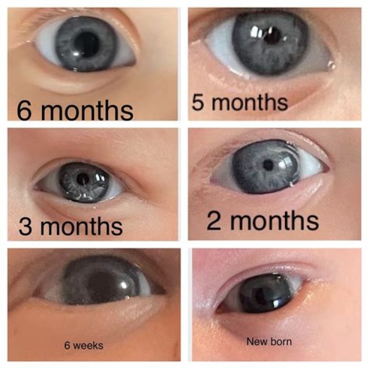 Why is my baby's color dark?
