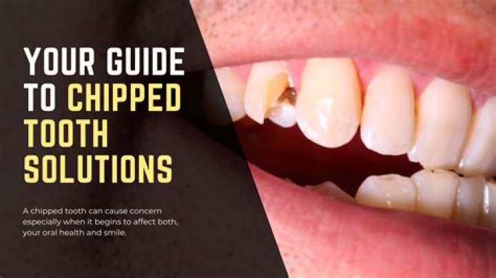 Will a chipped tooth get worse?